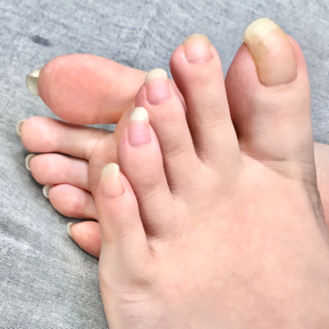 足の爪の表裏